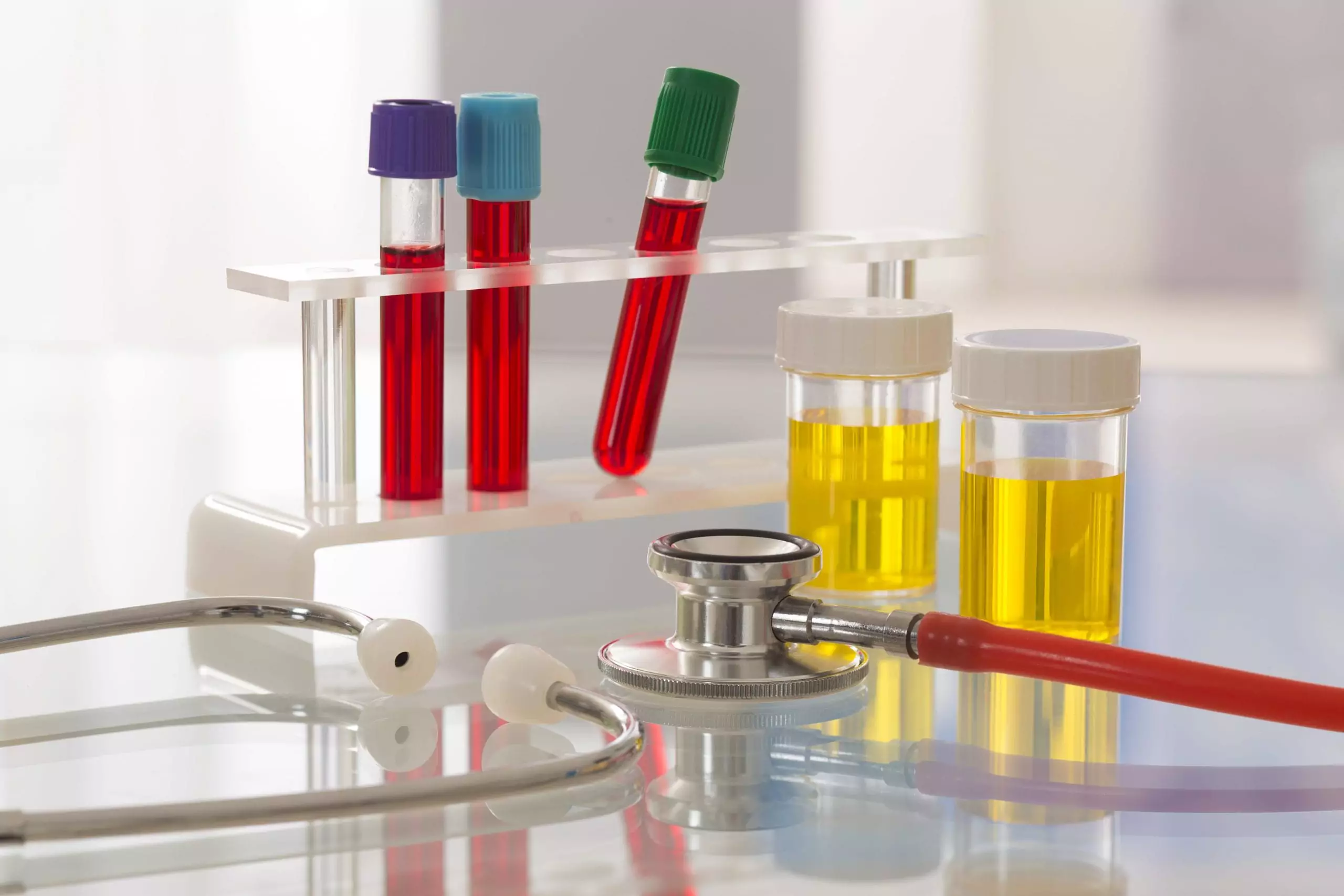 Vials of blood and urine next to stethoscope for kidney disease diagnosis