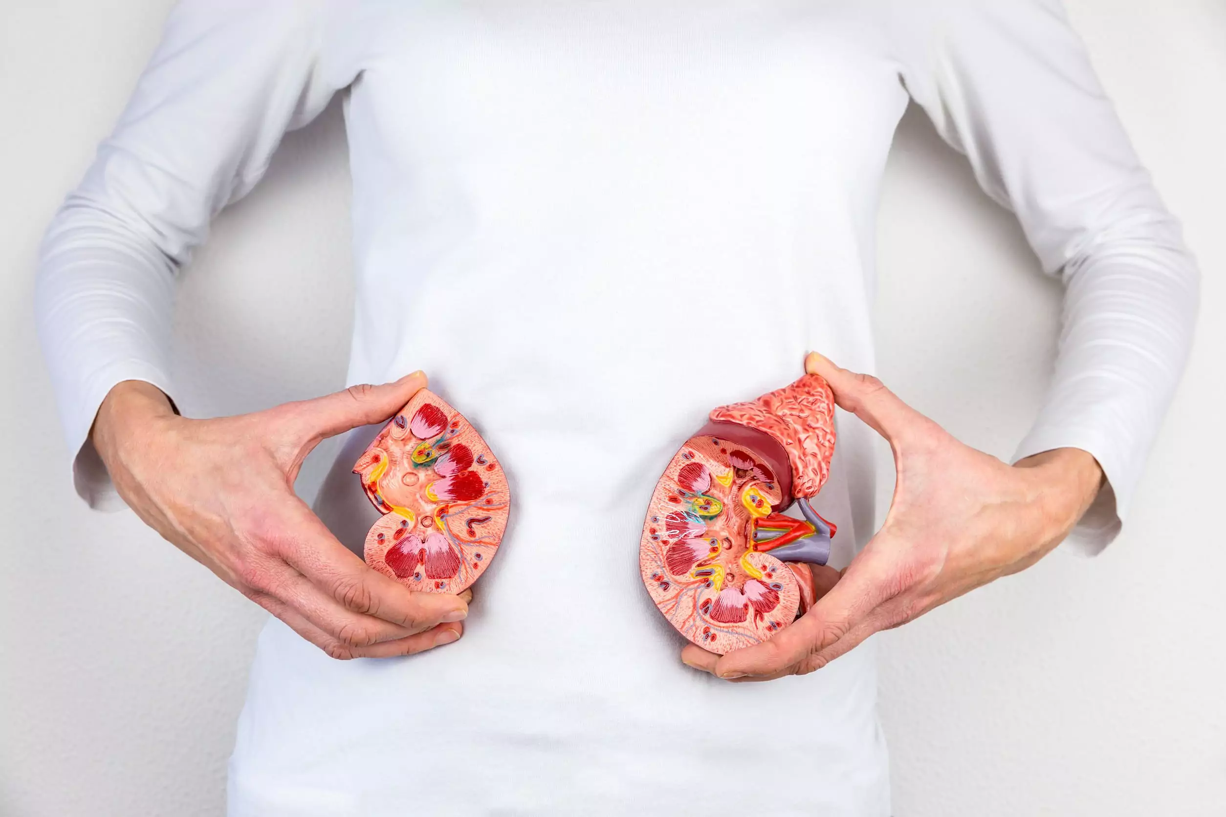 A person holds two fake kidneys for stage 3 kidney disease