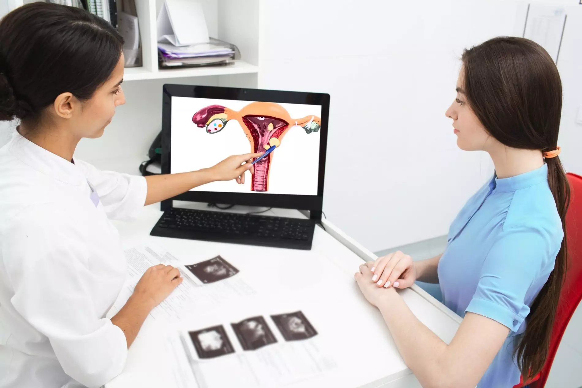Fibroid Degeneration: What You Need to Know