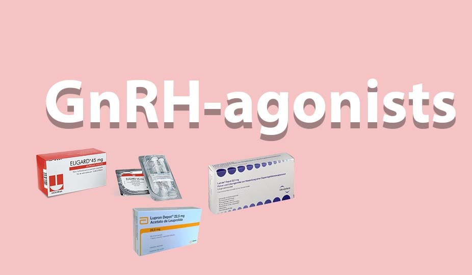 How GnRH Agonists Can Treat Fibroid Symptoms - Responsum Health